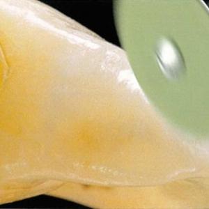 Dentál Centrum Pápa kezelések